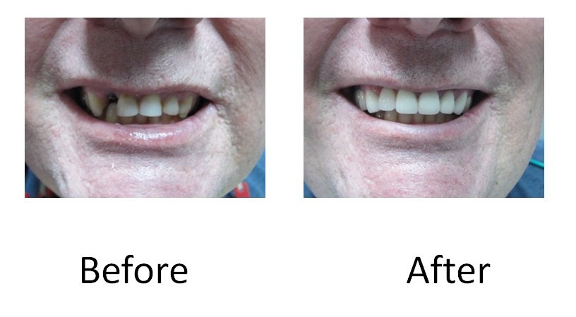 Estetico Manila Dental Clinic - Estetico Manila Dental Clinic