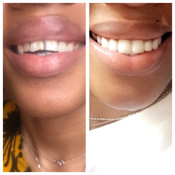 Estetico Manila Dental Clinic - Estetico Manila Dental Clinic