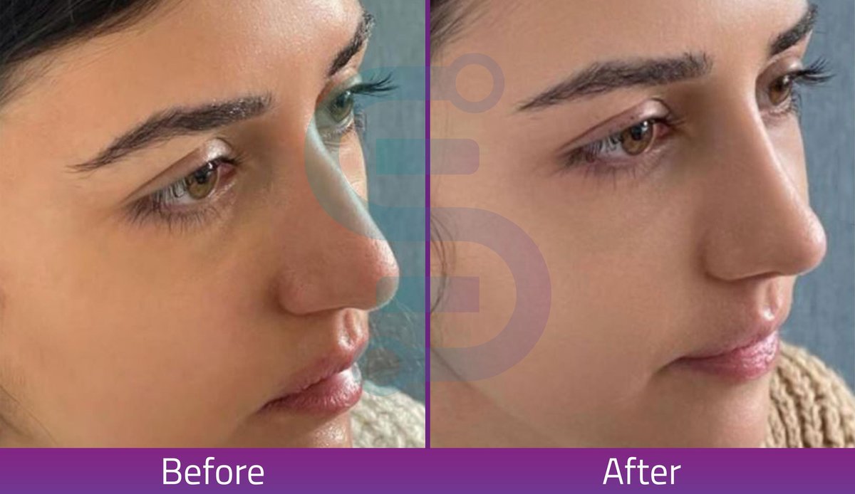 Estexper Beauty Clinic - Estexper Beauty Clinic