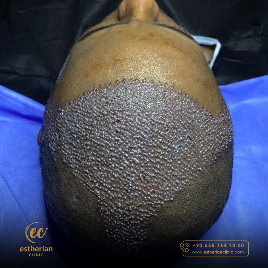 Estherian clinic - Estherian clinic