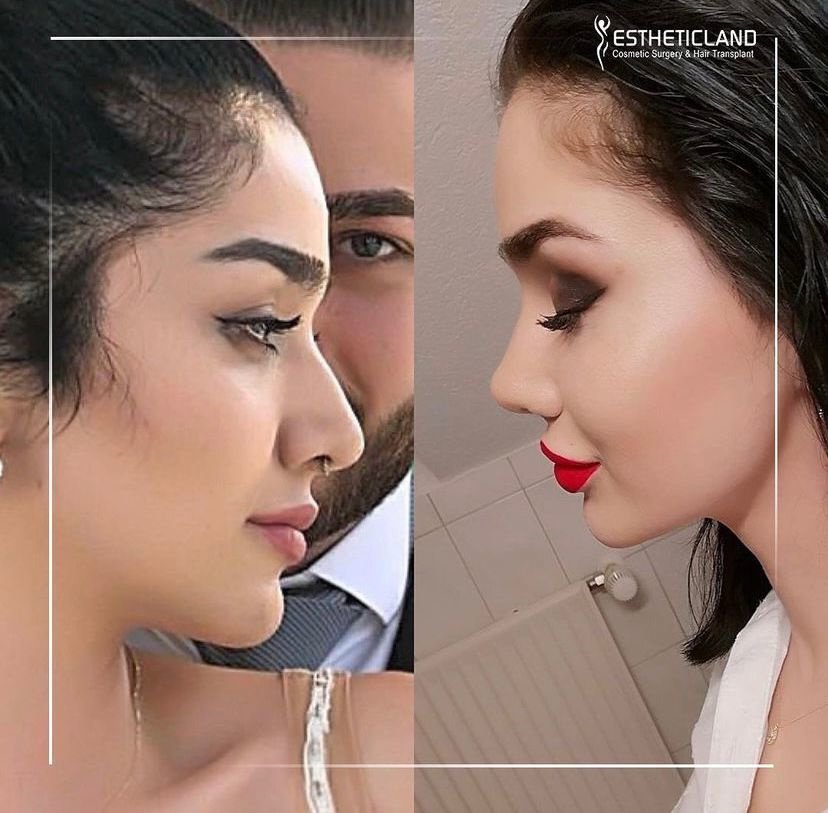 إيثيتيكلاند - Estheticland