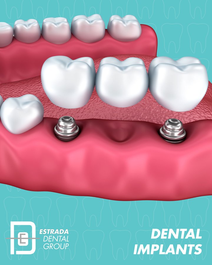 Estrada Dental Group - Estrada Dental Group