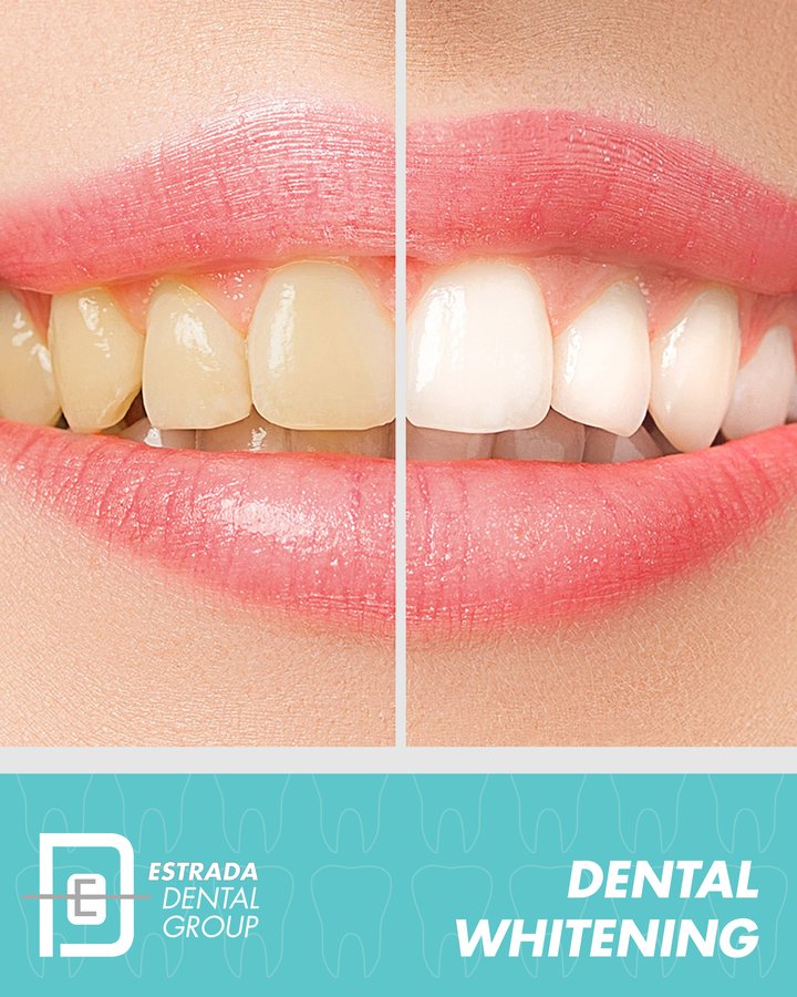 Estrada Dental Group - Estrada Dental Group