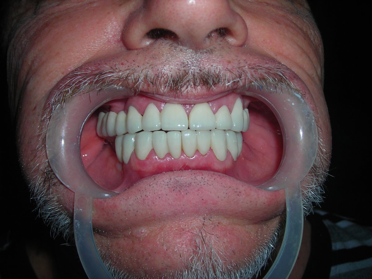 Eversmile Dental Clinic On ONGC Panel - Eversmile Dental Clinic On ONGC Panel