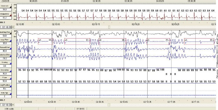 Evgenios Metaxas - Limassol Lung Health - Evgenios Metaxas - Limassol Lung Health