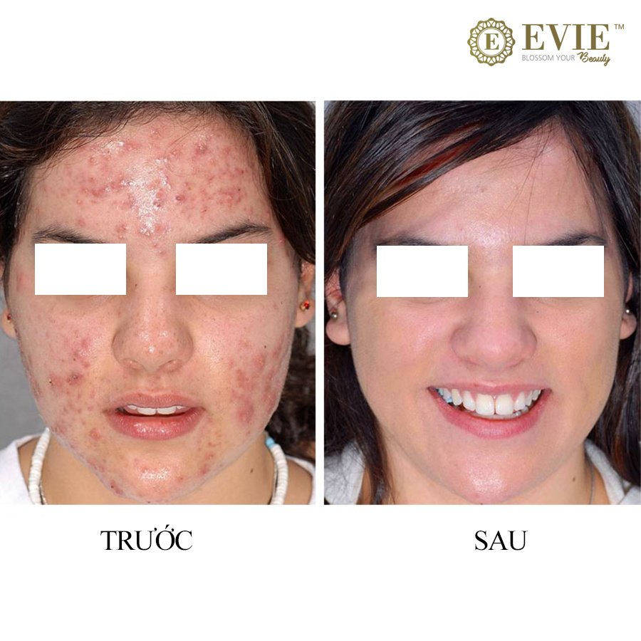 Evie Clinic & Spa - Evie Clinic & Spa