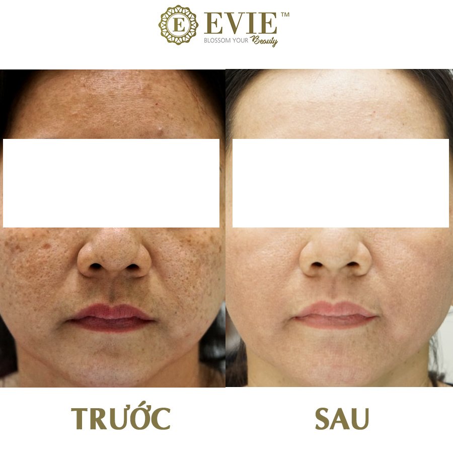 Evie Clinic & Spa - Evie Clinic & Spa