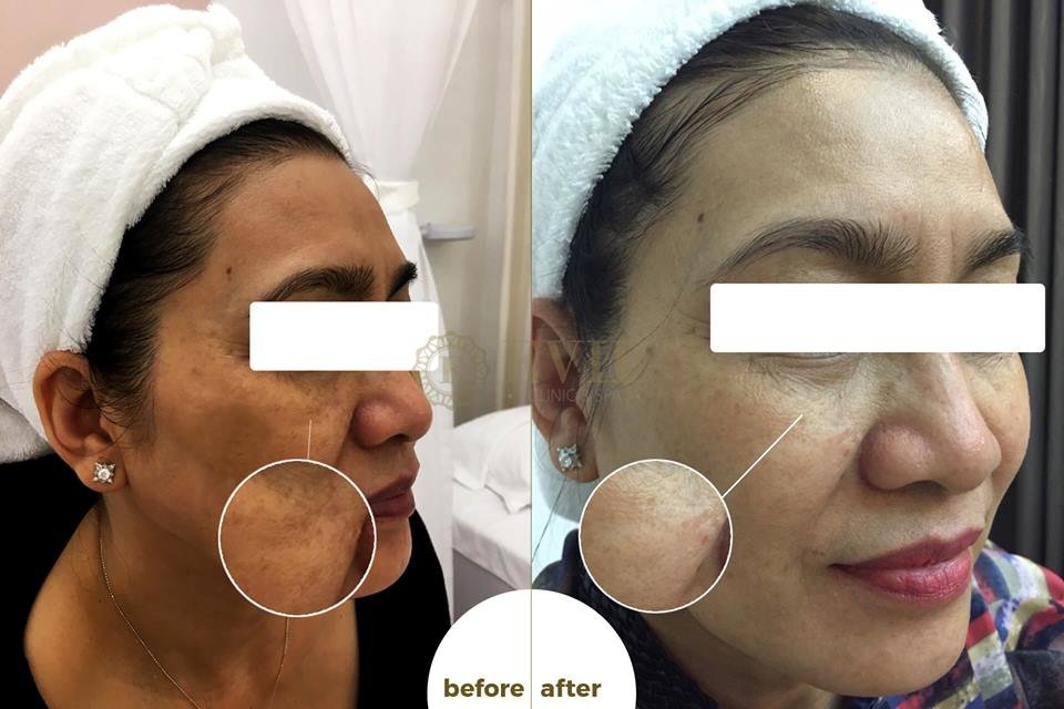 Evie Clinic & Spa - Evie Clinic & Spa