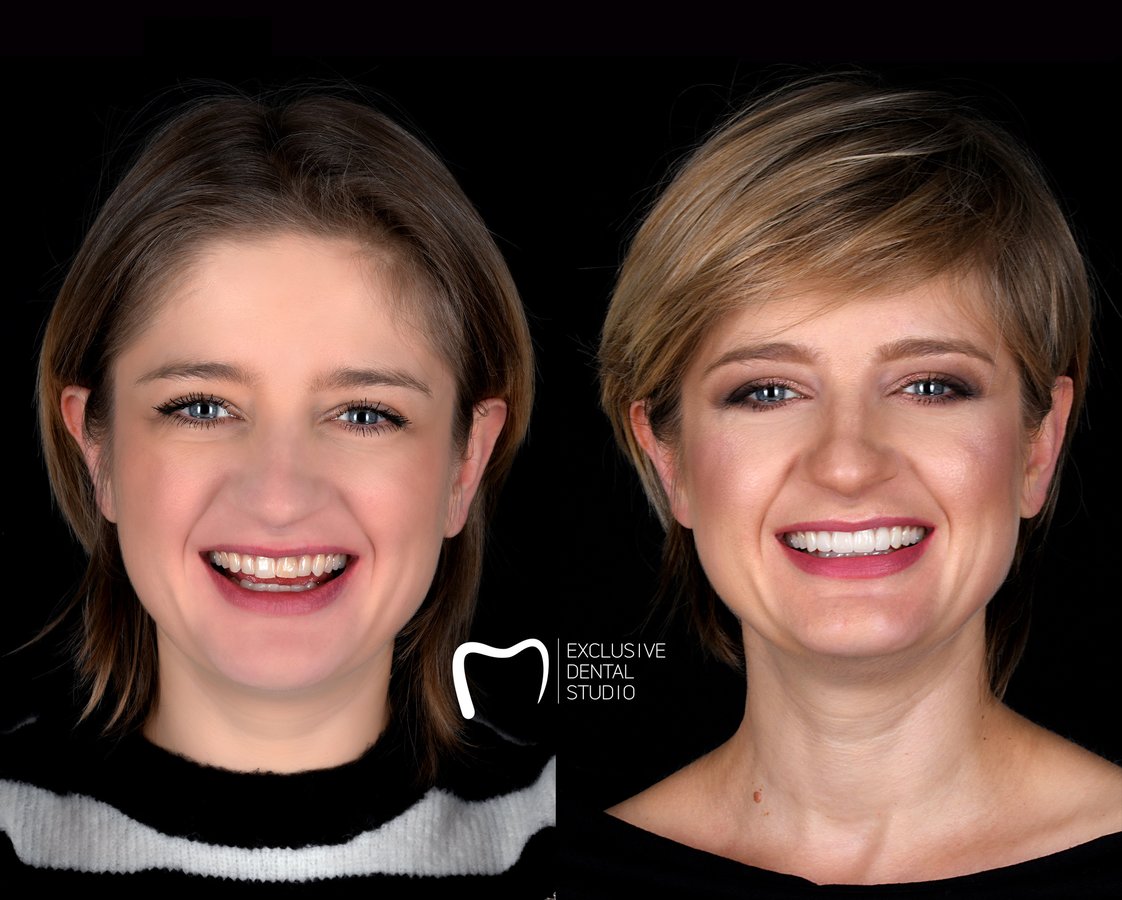 Exclusive Dental Studio - CH Posnania - Exclusive Dental Studio - CH Posnania