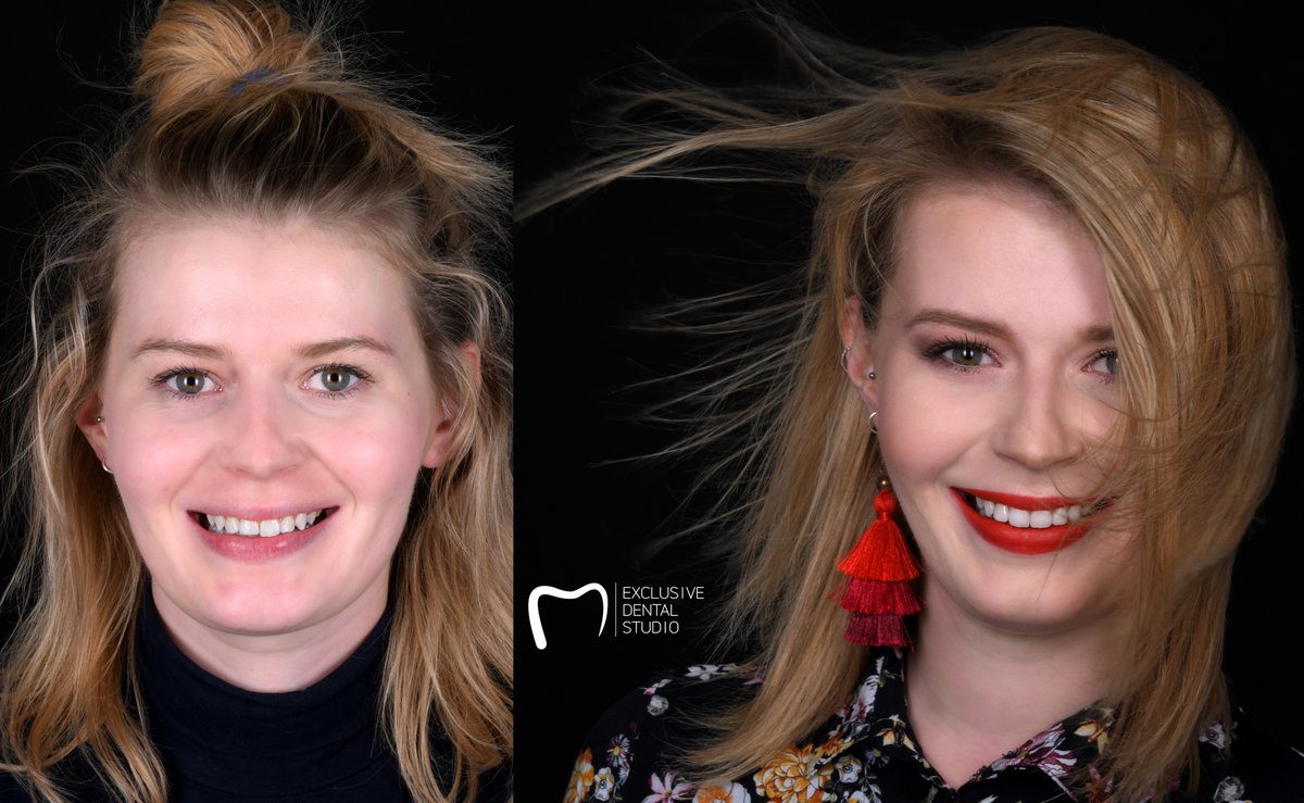 Exclusive Dental Studio - CH Posnania - Exclusive Dental Studio - CH Posnania