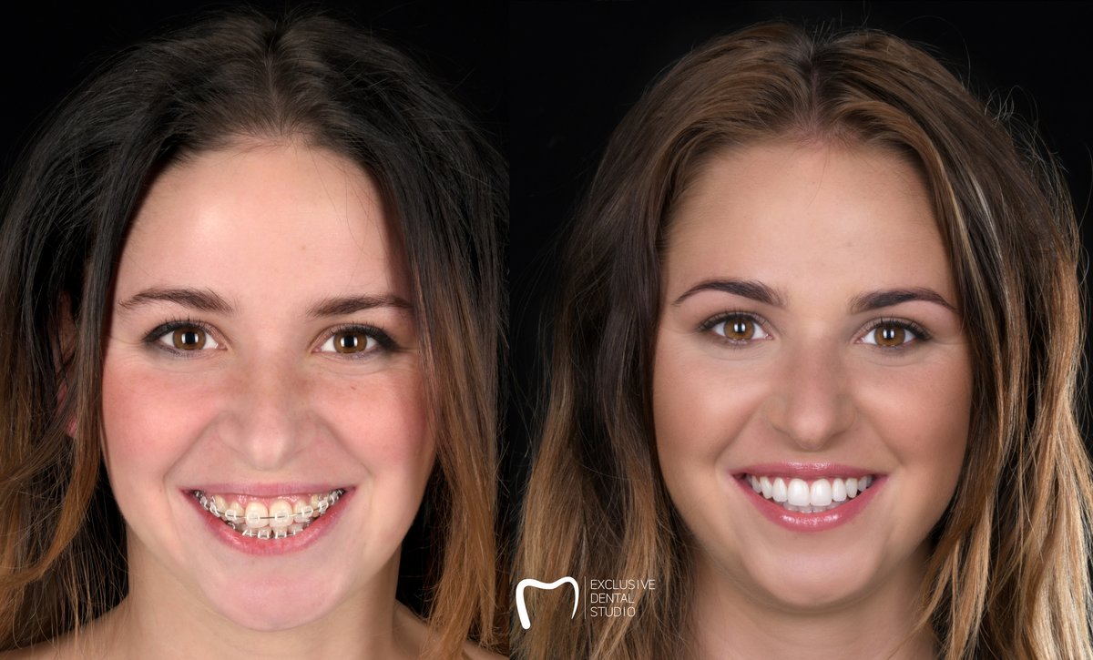 Exclusive Dental Studio - CH Posnania - Exclusive Dental Studio - CH Posnania