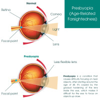 Eye Physicians - Eye Physicians