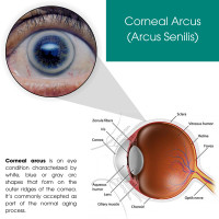 Eye Physicians - Eye Physicians