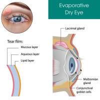 Eye Physicians - Eye Physicians
