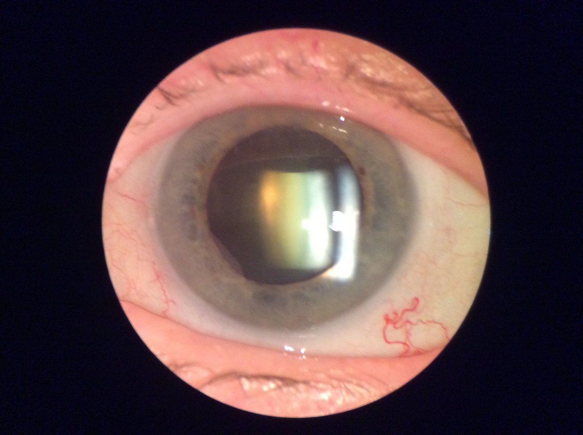 جراحي العيون SA - Kurralta Park - Eye Surgeons SA - Kurralta Park