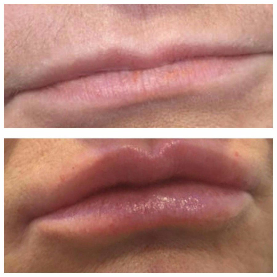 Facelook Aesthetics - Facelook Aesthetics