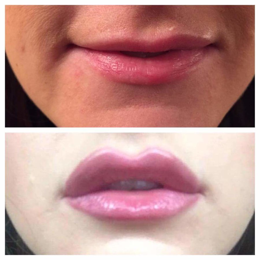 Facelook Aesthetics - Facelook Aesthetics