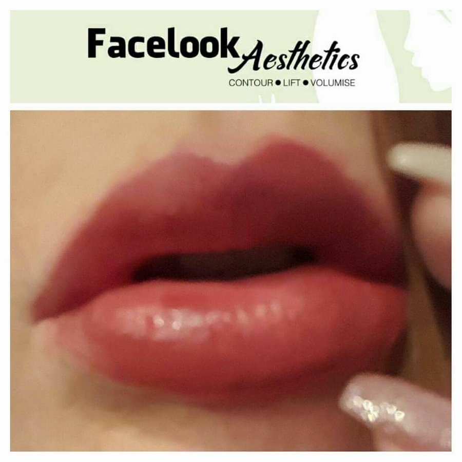 Facelook Aesthetics - Facelook Aesthetics