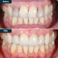 Family Cosmetic & Implant Dentistry of Brooklyn - Family Cosmetic & Implant Dentistry of Brooklyn