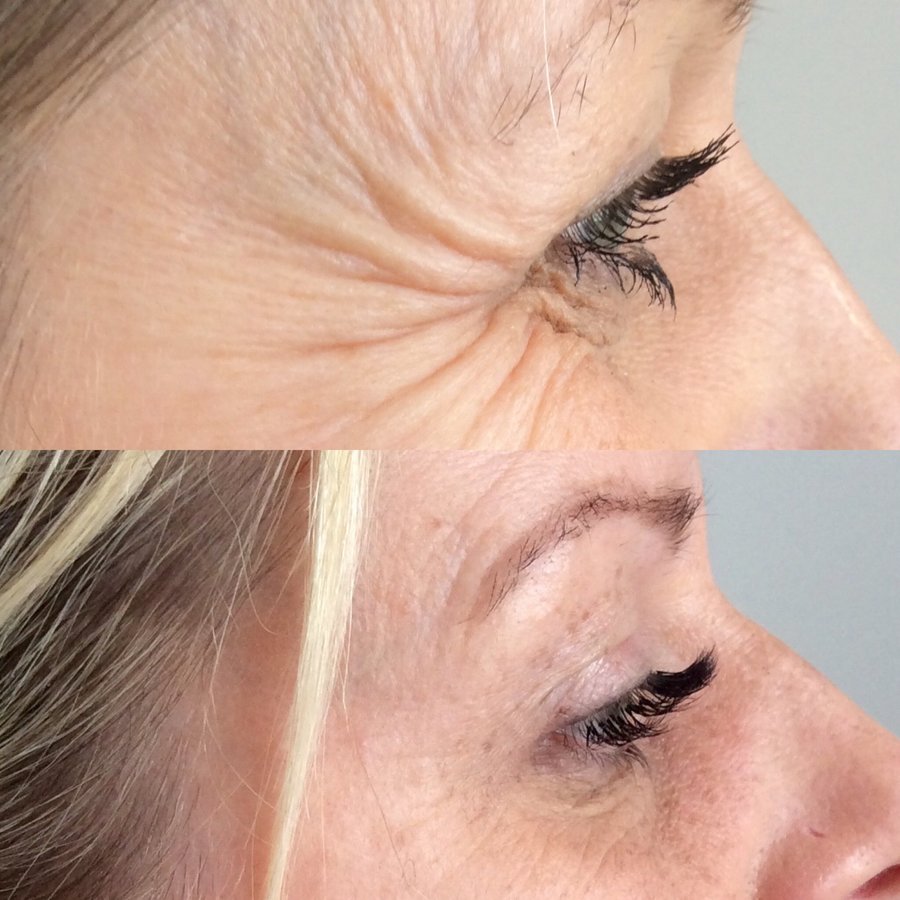 Ferndown Aesthetics - Ferndown Aesthetics