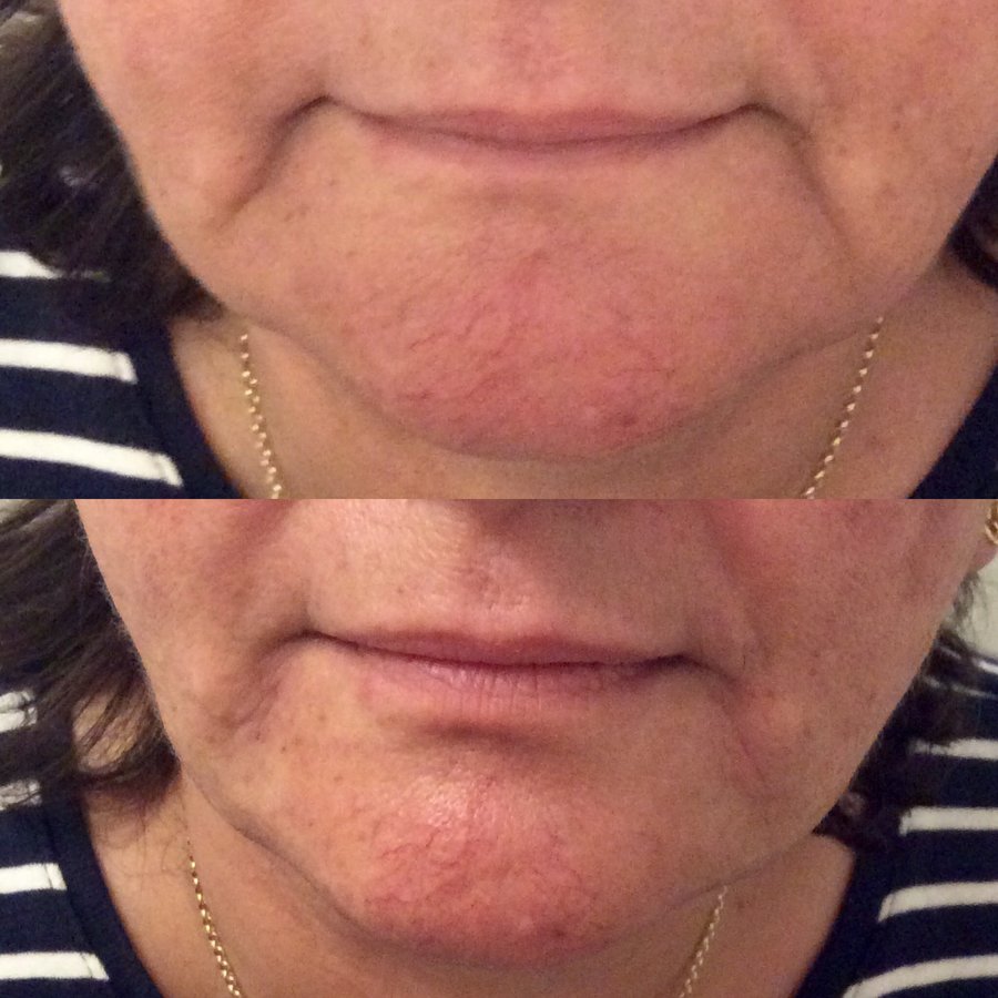 Ferndown Aesthetics - Ferndown Aesthetics