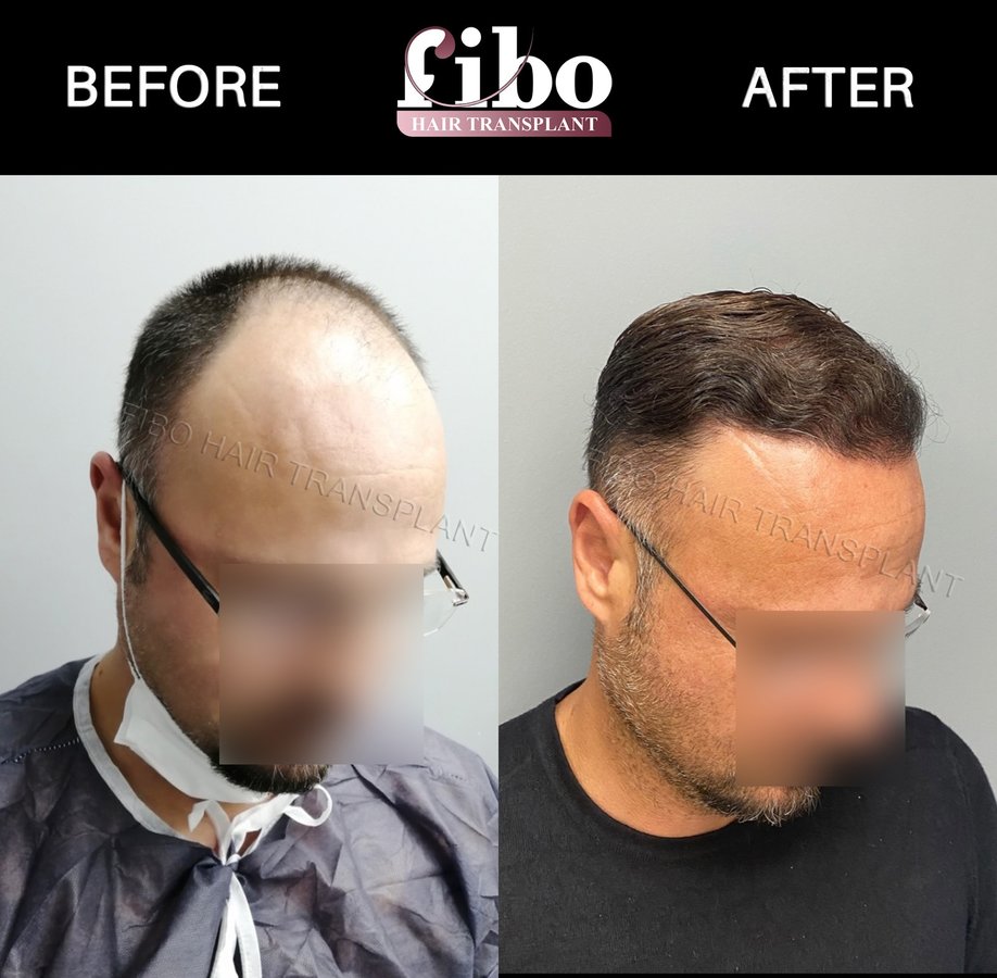 Fibo Health - Fibo Health