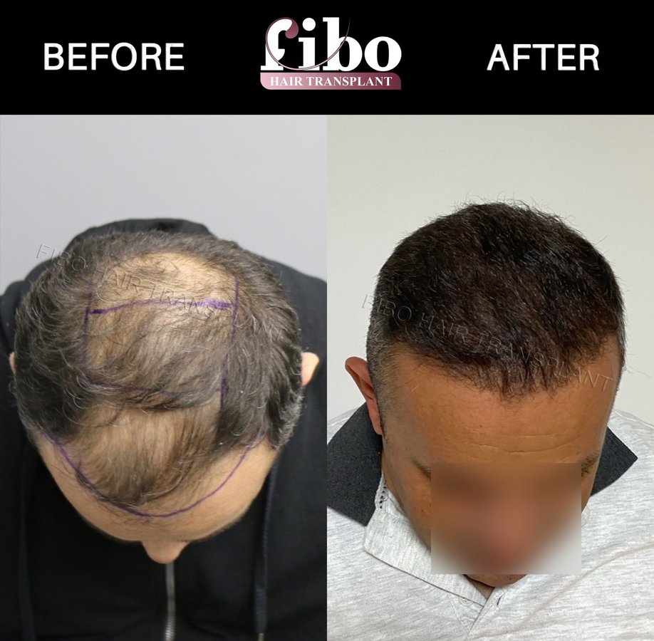 Fibo Health - Fibo Health