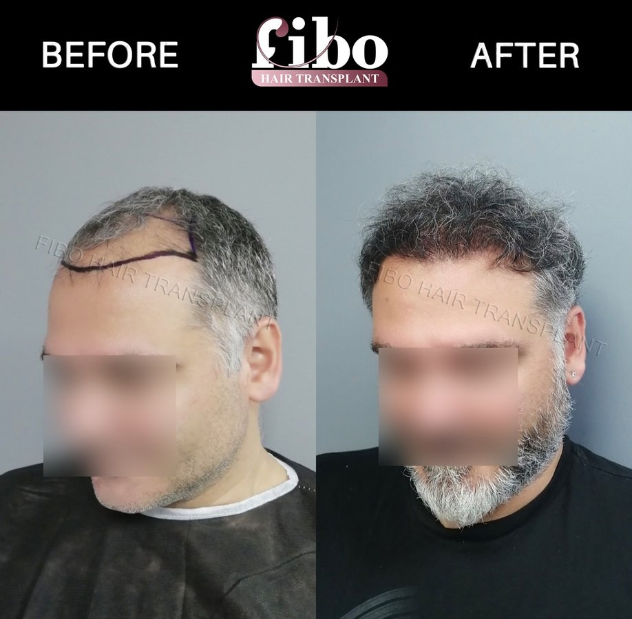 Fibo Health - Fibo Health