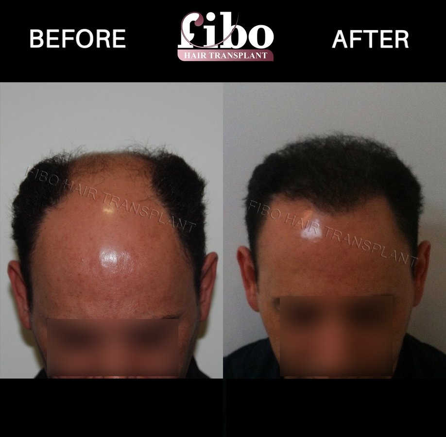 Fibo Health - Fibo Health