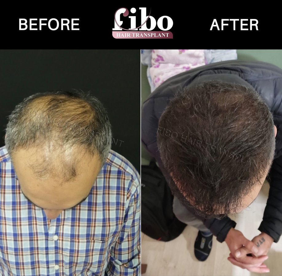 Fibo Health - Fibo Health