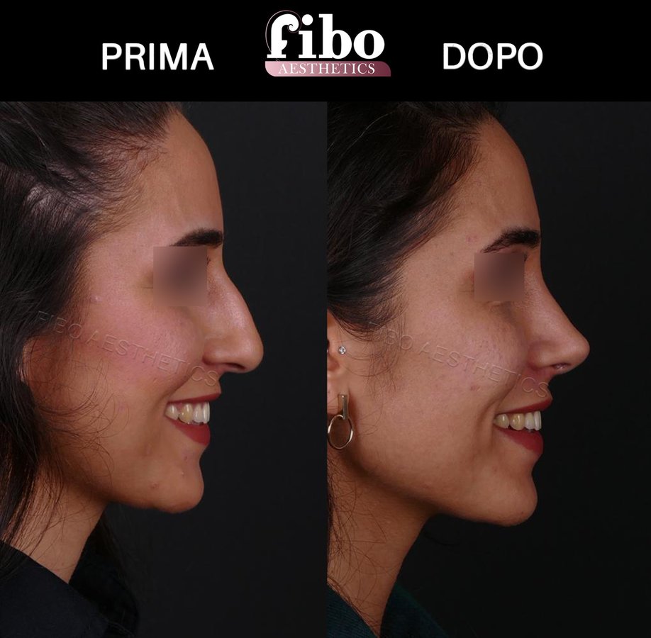 Fibo Health - Fibo Health