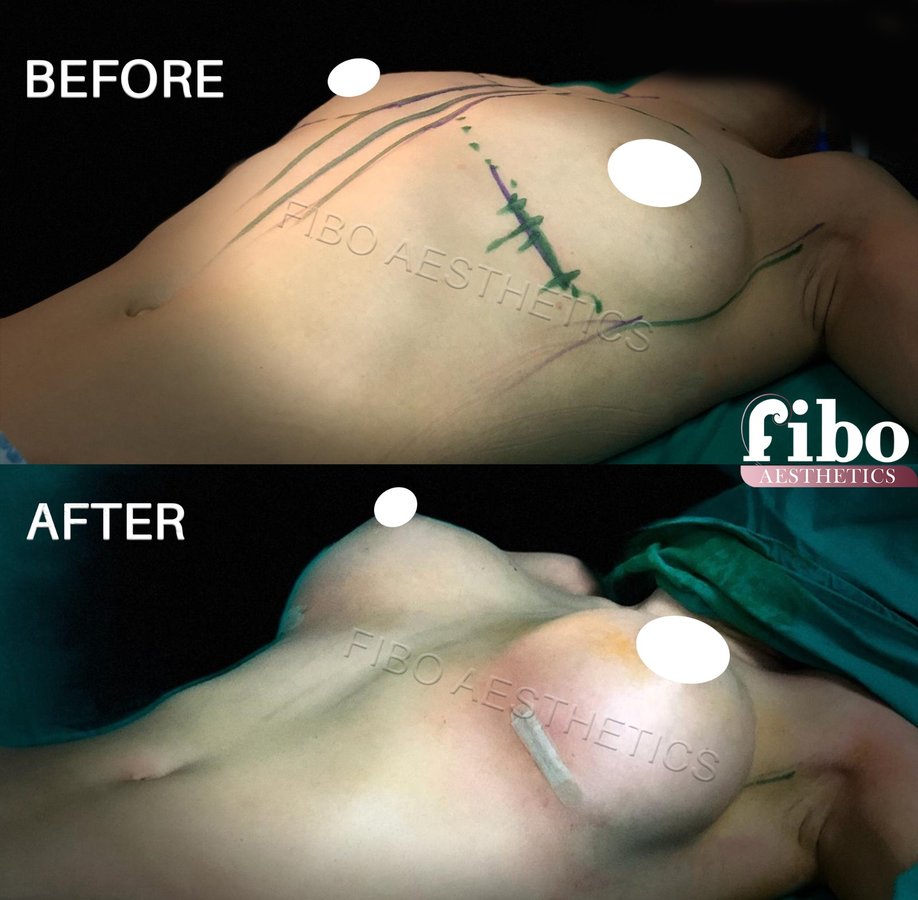 Fibo Health - Fibo Health