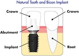 Fine Feather Dental Care - Fine Feather Dental Care