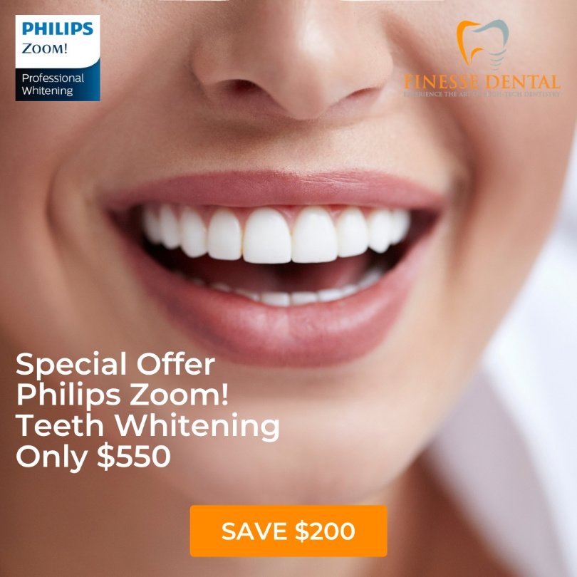 Finesse Dental - Finesse Dental