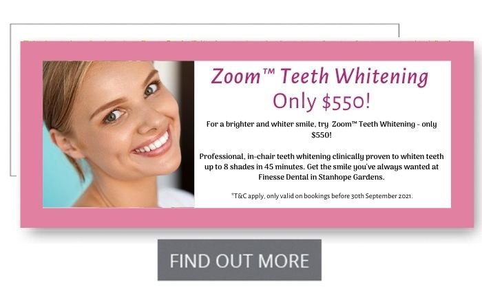 Finesse Dental - Finesse Dental