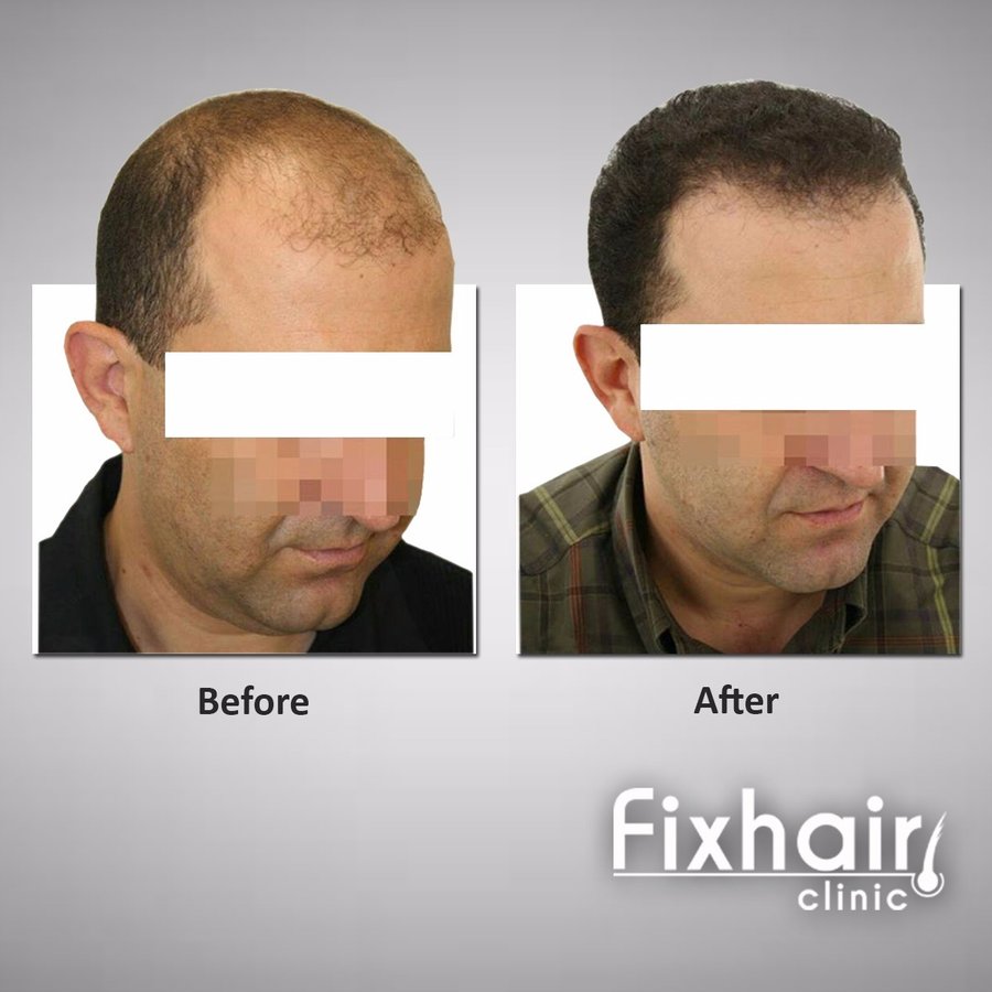 Fix Hair Clinic - Fix Hair Clinic