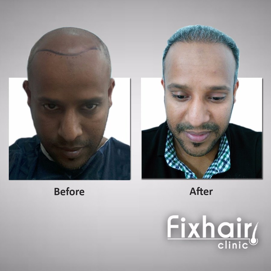 Fix Hair Clinic - Fix Hair Clinic