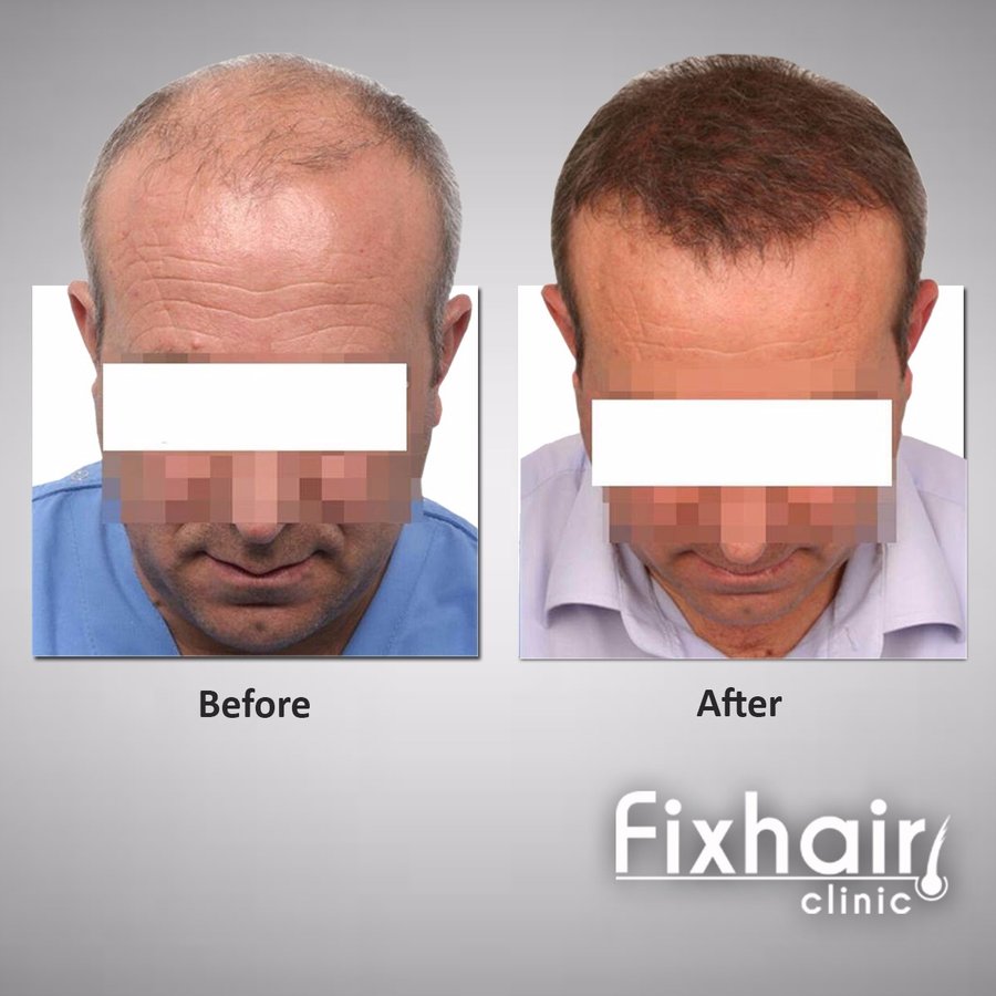 Fix Hair Clinic - Fix Hair Clinic