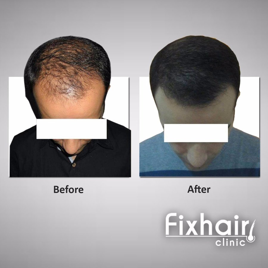 Fix Hair Clinic - Fix Hair Clinic