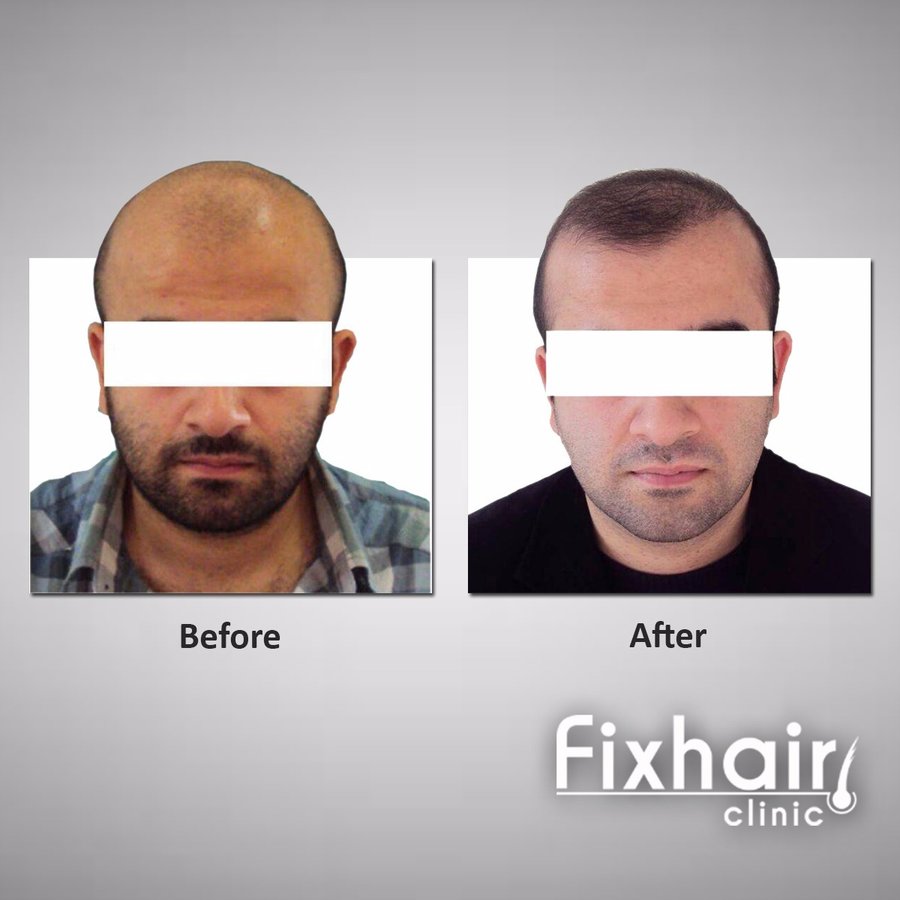 Fix Hair Clinic - Fix Hair Clinic