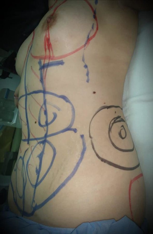 Flare Clinic - Dr Ahmed Harfoush - Flare Clinic - Dr Ahmed Harfoush