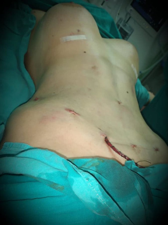 Flare Clinic - Dr Ahmed Harfoush - Flare Clinic - Dr Ahmed Harfoush