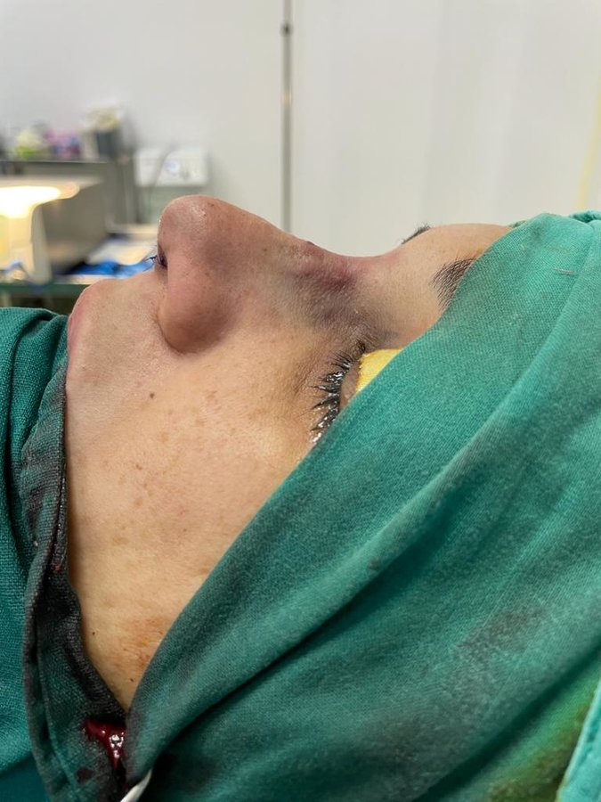 Flare Clinic - Dr Ahmed Harfoush - Flare Clinic - Dr Ahmed Harfoush