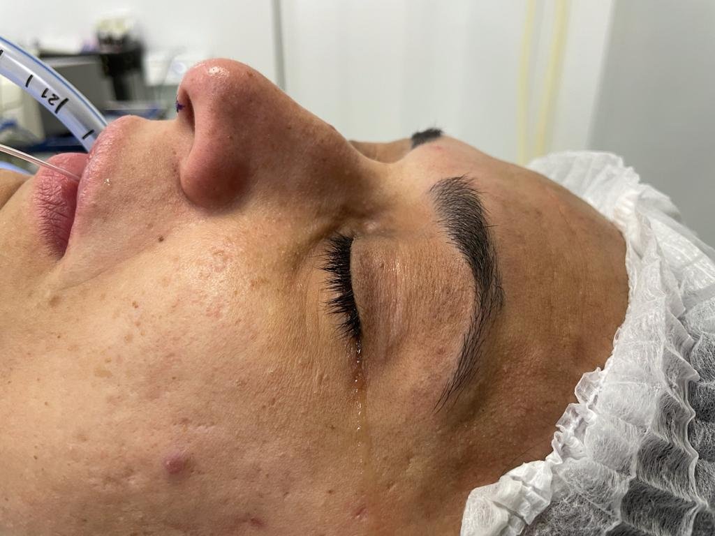 Flare Clinic - Dr Ahmed Harfoush - Flare Clinic - Dr Ahmed Harfoush