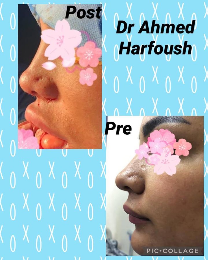 Flare Clinic - Dr Ahmed Harfoush - Flare Clinic - Dr Ahmed Harfoush