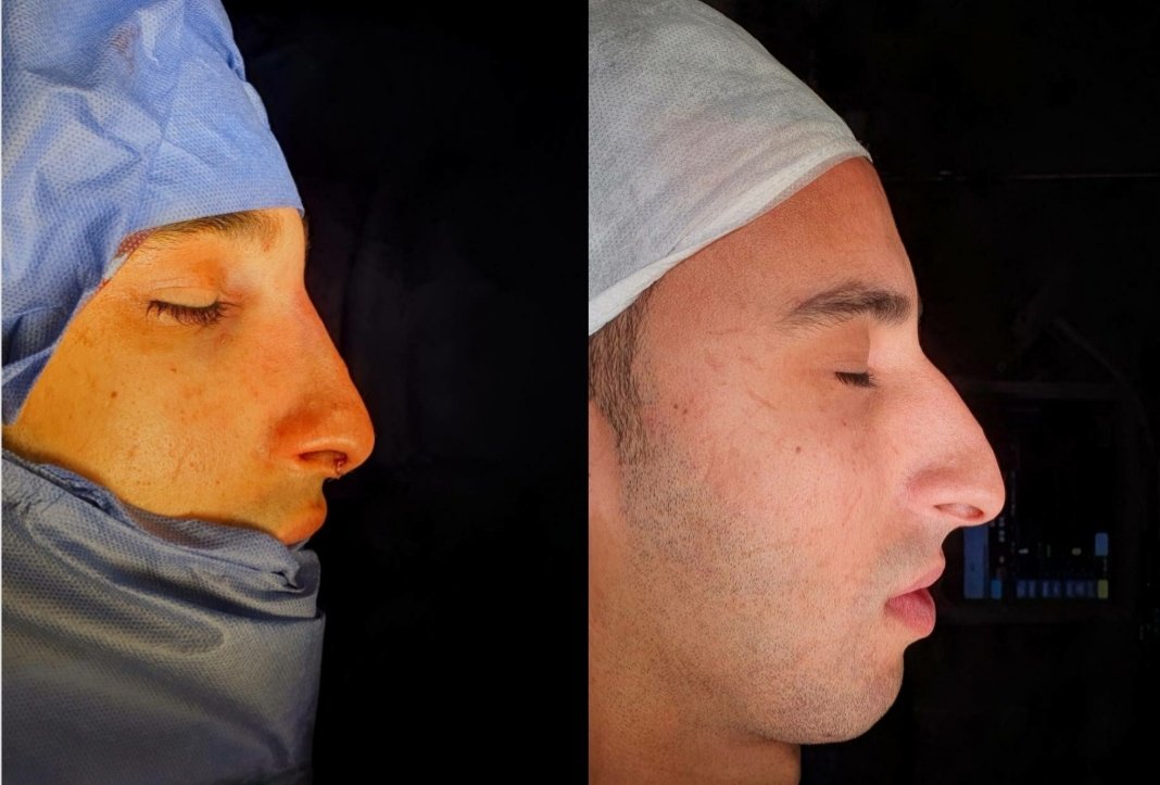 Flare Clinic - Dr Ahmed Harfoush - Flare Clinic - Dr Ahmed Harfoush