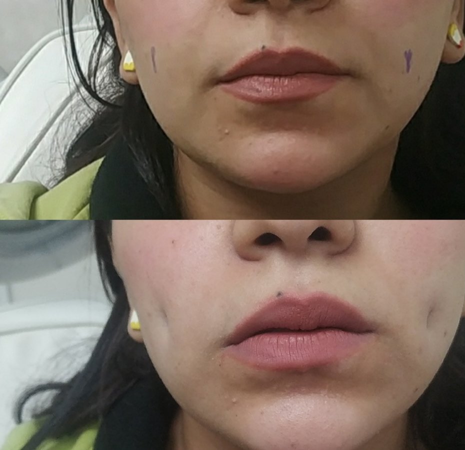 Flare Clinic - Dr Ahmed Harfoush - Flare Clinic - Dr Ahmed Harfoush