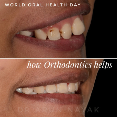 Fort Dental Clinic - Fort Dental Clinic