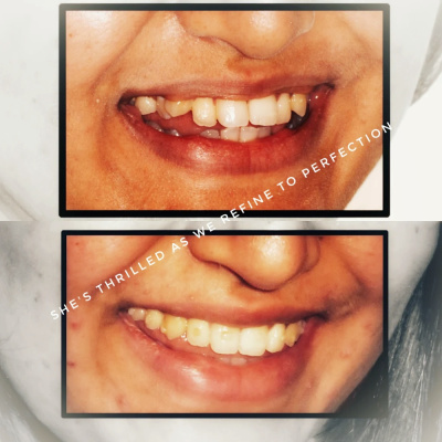 Fort Dental Clinic - Fort Dental Clinic