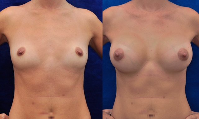 Franklin Peña - Santo Domingo - Franklin Peña - Santo Domingo